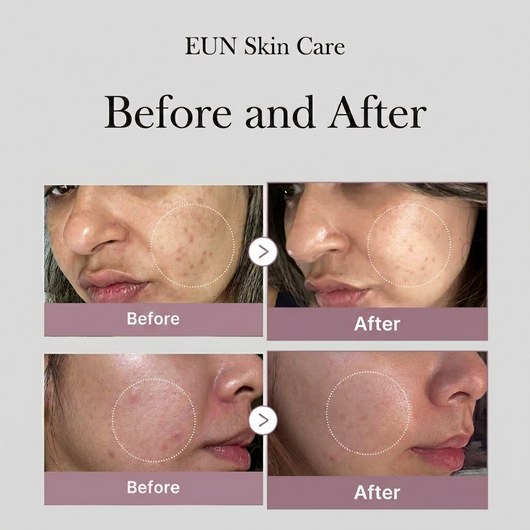 EUN PDRN Recovery Serum
