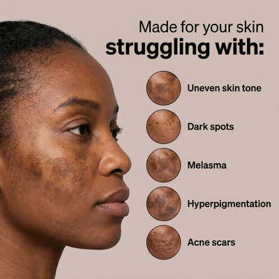 EUN PDRN Brightening Formula for Melasma, Acne scars & Hyperpigmentation