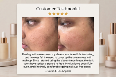 EUN PDRN Brightening Formula for Melasma, Acne scars & Hyperpigmentation