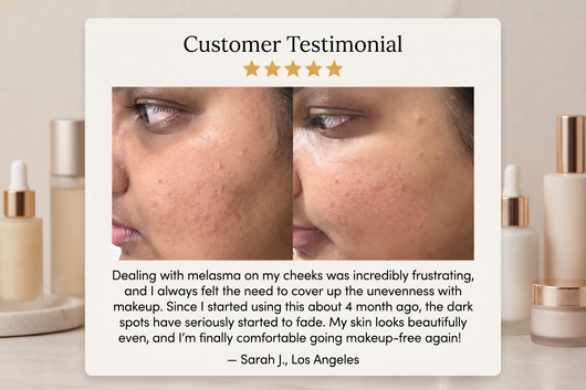 EUN PDRN Brightening Formula for Melasma, Acne scars & Hyperpigmentation
